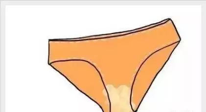 透过内裤看妇科病的蛛丝马迹!女人一定要注意