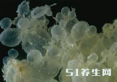 真没想到（血检测假怀孕怎么回事）查血会有假怀孕的症状 第2张