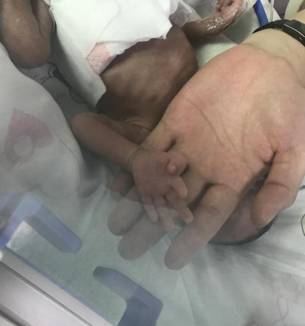 深圳一早产男婴病危住院，登记年龄为17岁的父母失联超两周
