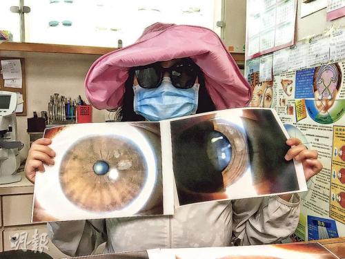 女子展示其受伤眼睛的照片。图片来源：香港《明报》 许芳文/摄