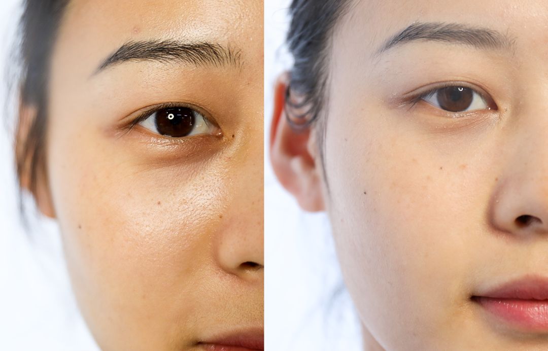 熬夜黑眼圈愁skr人?七夕怎样才能约到男神!