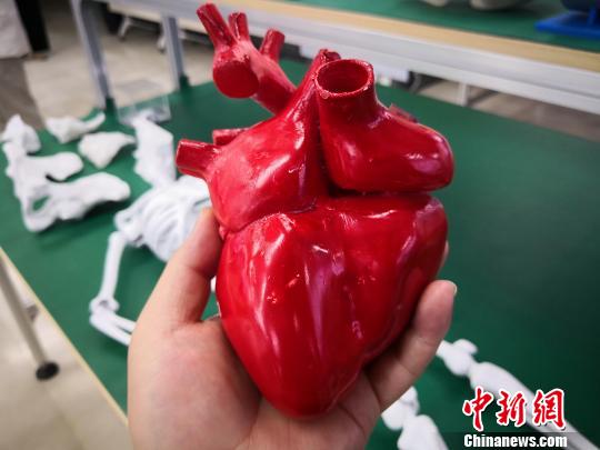 图为3D打印的心脏模型。　魏建军 摄