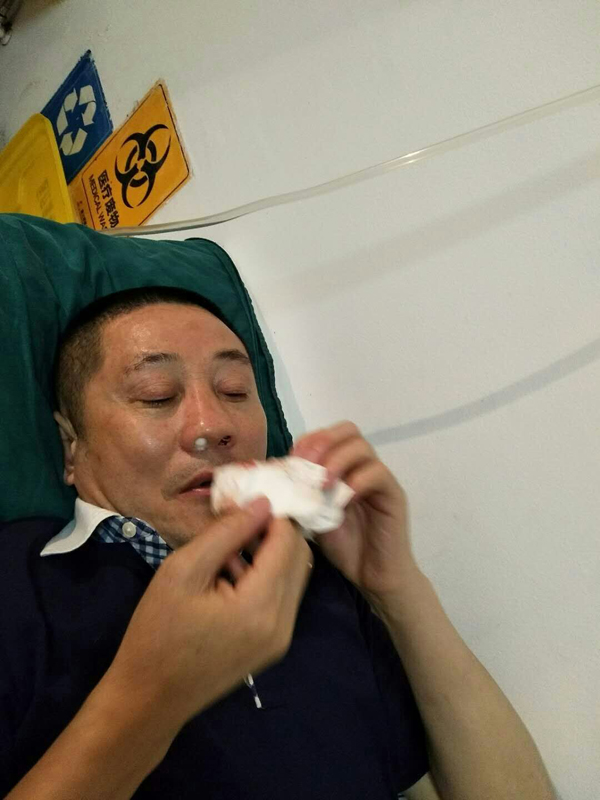 重庆一男子被指打伤举报人，警方：已执行逮捕，正侦办