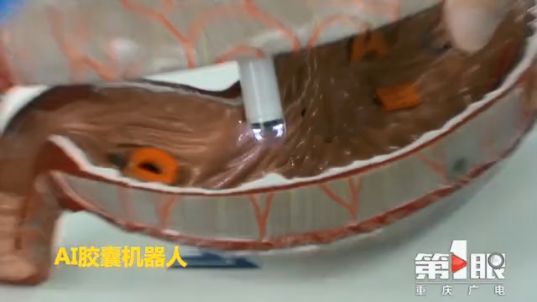 智博会抢先看 | AI胶囊机器人 告别肠胃镜检查的