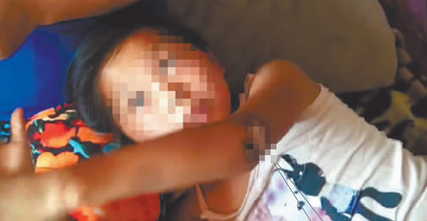 哈尔滨10岁女孩被脱落网线电倒 2玩伴冒险挪线救人