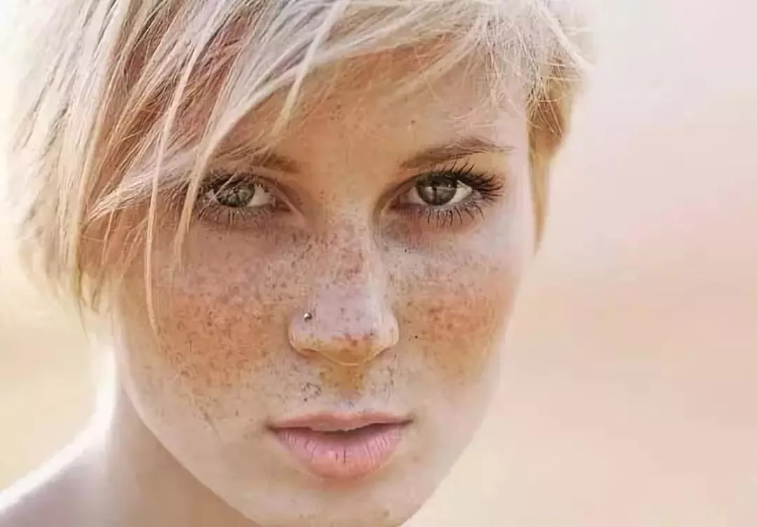 中年女性脸上长斑的原因