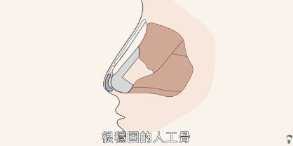 抖音彭于晏做了个隆鼻变成了3个鼻孔