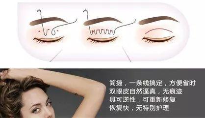 原来单眼皮的你连精致的猪猪女孩都做不了亲我我抱女生图片