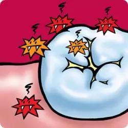 牙齿黑线:别看我不起眼,疼起来要人命!