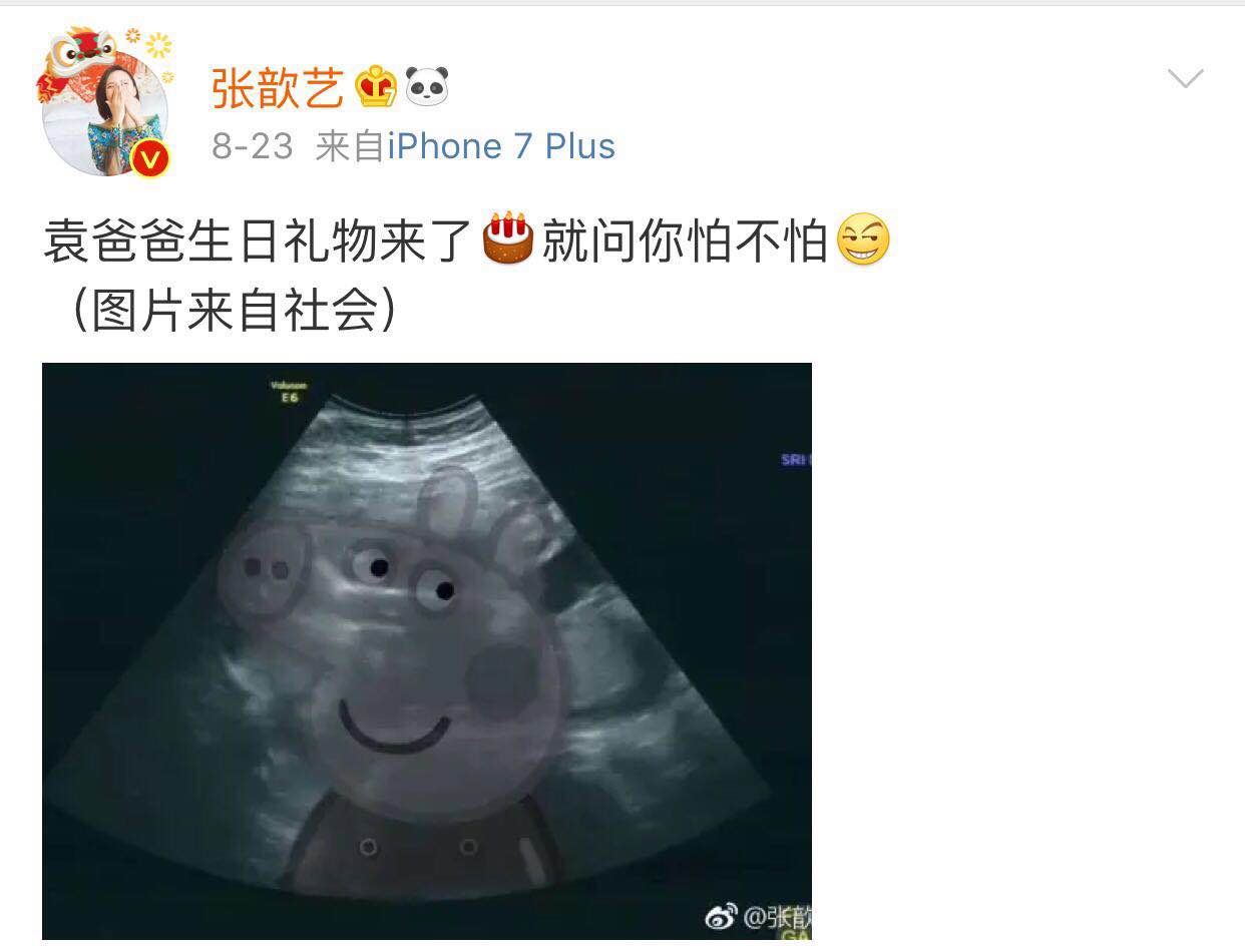 张歆艺怀孕5月发福明显 网友：脸肿得像气球