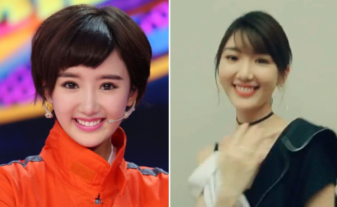 那些热衷玻尿酸的女明星,我劝你们适可而止!-秒速推