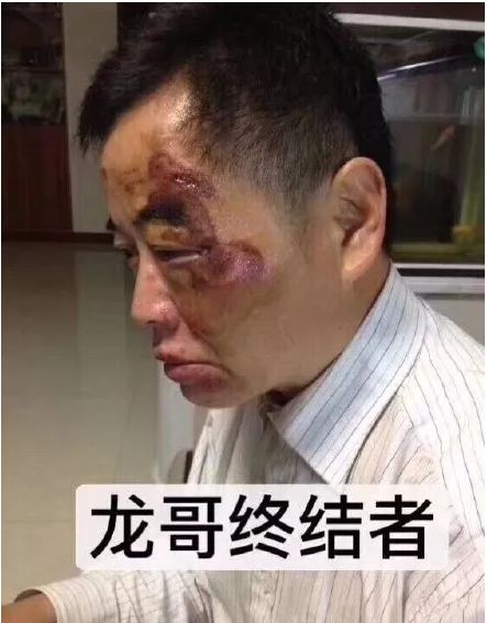 昆山龙哥走的第四天,反杀男身份终于曝光!