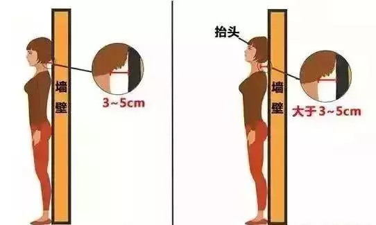 后最凹陷处与墙面之间的距离,如果在3厘米～5厘米间,那么你就是驼背了