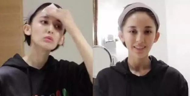 想去黑头、去闭口?这步没做好一切都是白搭!