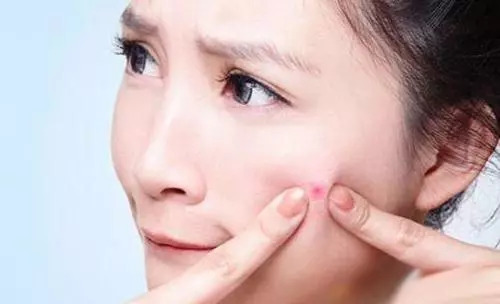 我到底应该用那种酸?A酸、果酸、水杨酸、杏