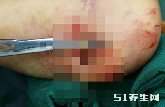 小孩子戴手环注意事项 小孩子戴手环注意事项