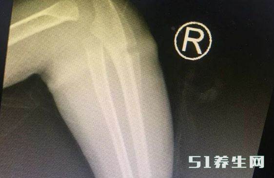 小孩戴手镯 小孩戴手镯