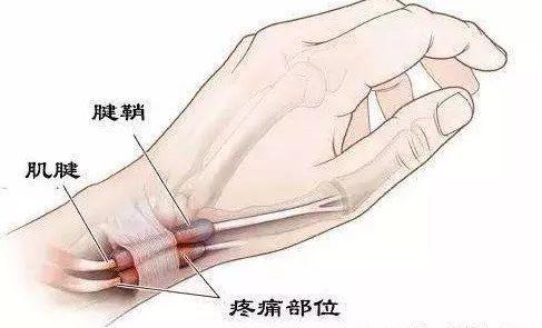封闭针是呢?三叶草玩滑板图片