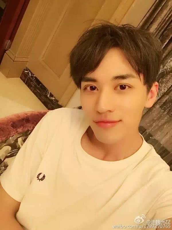 戚薇整容后眼睛浮肿,热巴许魏洲的宽双眼皮,化