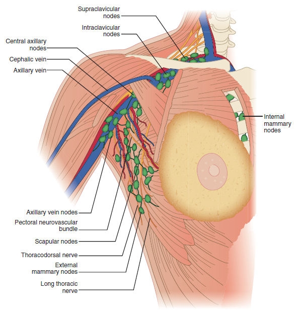 腋窝淋巴结转移状况,是判断乳腺癌预后和指导辅助治疗选择最重要的
