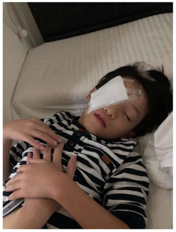 香港男星6岁儿子惨遭铅笔插眼睛 右眼视网膜受损
