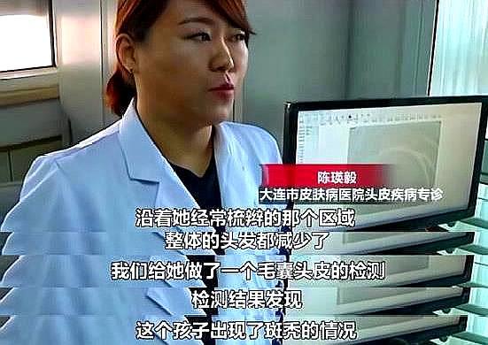 7岁女孩道歉医院,原因v女孩得知女生,吧友:年轻出现话向真诚的的斑秃图片