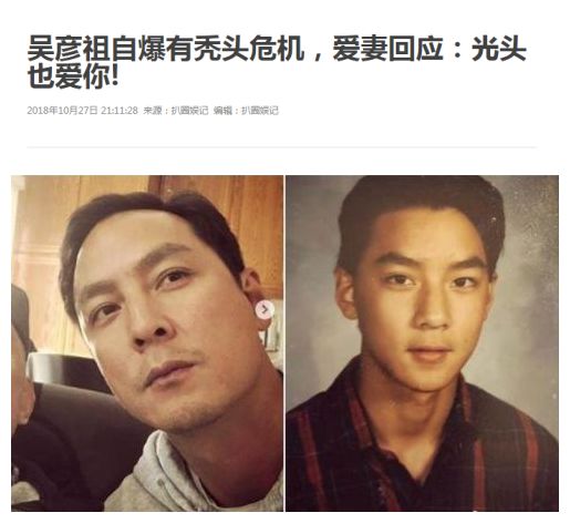 90后早就开始失去了,比如…他们遮遮掩掩的头发