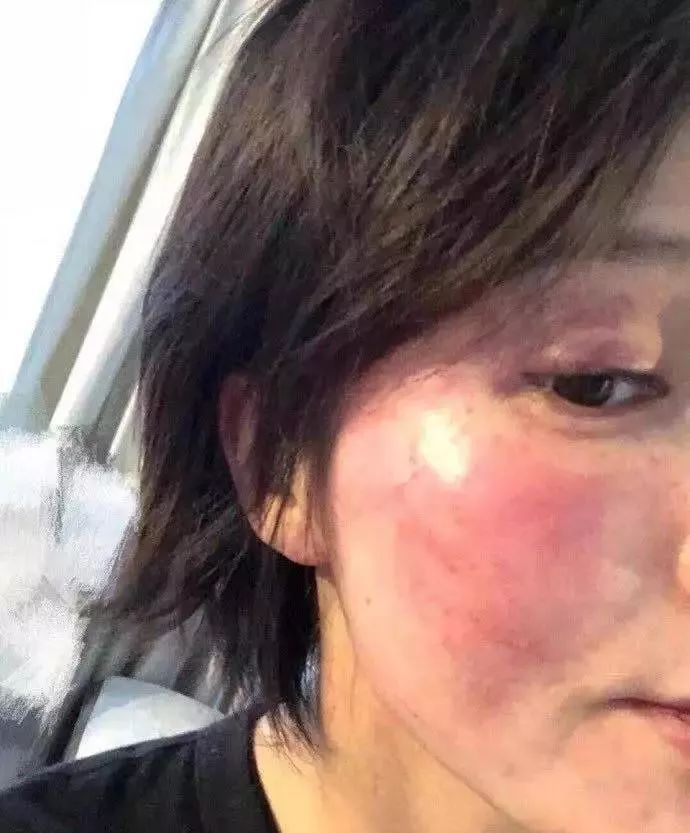 家暴,出轨,隐婚,哪一个才是真正的黄景瑜?