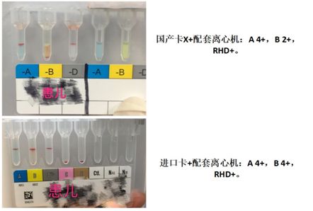 【检验临床面对面】玻片法"ab "型,凝胶微柱卡"a "型