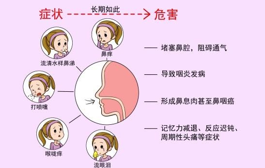首大刘玉梅:冬季预防过敏性鼻炎的要点