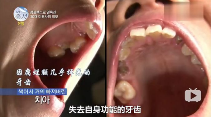 丑到被亲生父亲嫌弃，花了8543万整容，逆天改命现实版