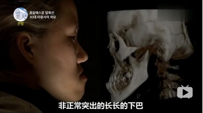 丑到被亲生父亲嫌弃，花了8543万整容，逆天改命现实版