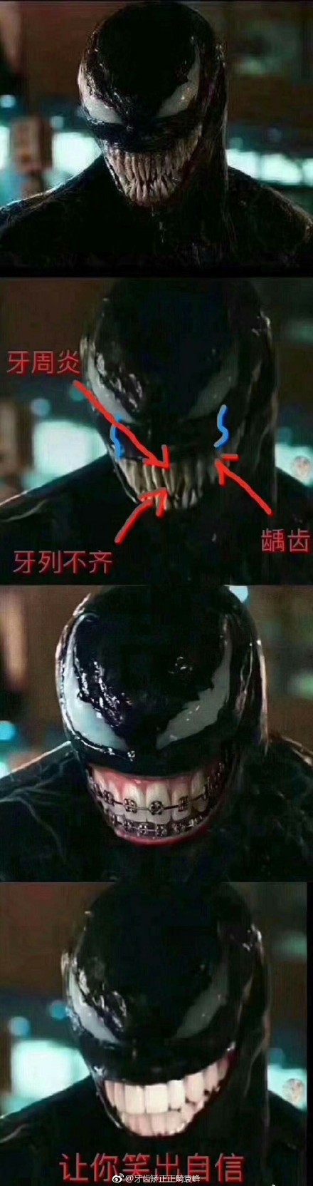 毒液小可爱，听话，我们去整整牙