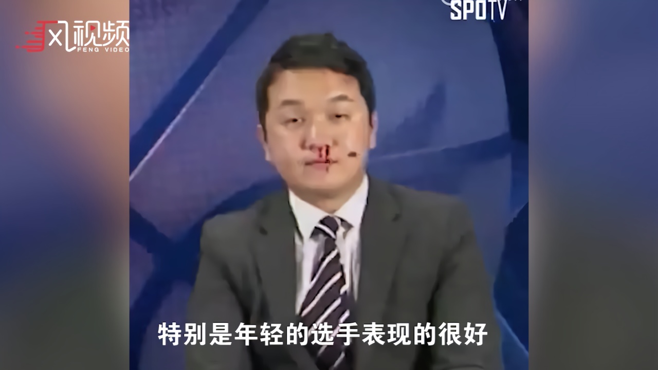 主持人镜头前鼻血狂流 化身“淡定哥”擦掉搭档一脸懵