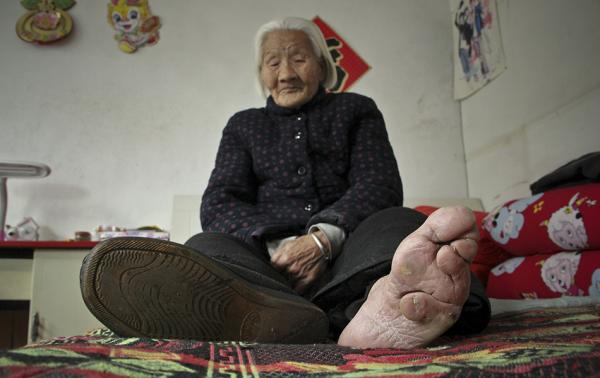 古代女子缠足是为了"美貌"?新研究表明事情没那么简单