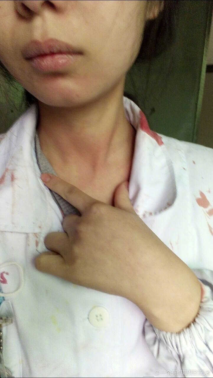 这个小护士被掐住脖子打了一拳,身上沾满了患者的血