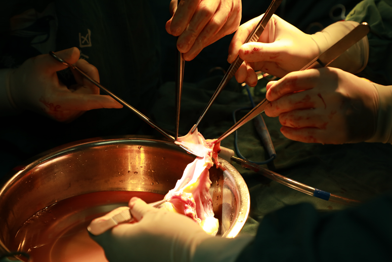 安徽省完成首例心脏捐献,首例器官捐献心脏移植