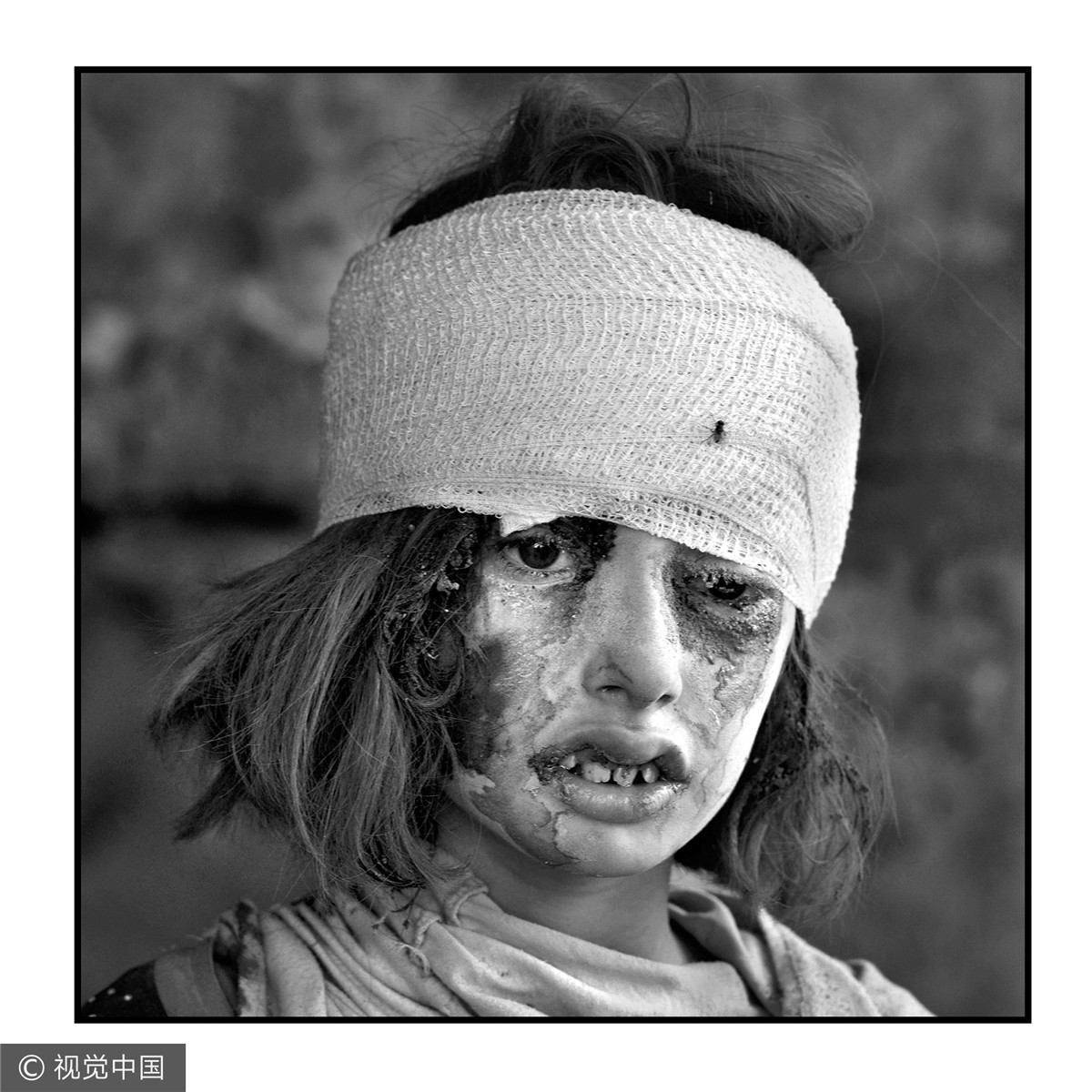 普利策奖得主带你走近伊拉克摩苏尔战争