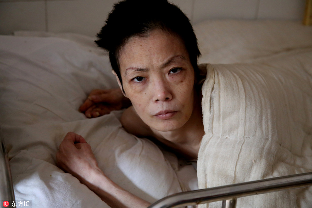 湖南临澧一女子患奇病三年卧床不起 其夫坚称妻子曾遭遇"咒语"