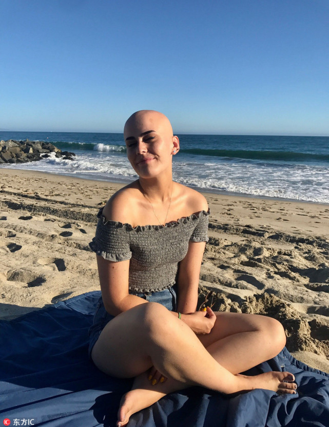 1/6美国洛杉矶,当sarah rose meyers的父母第一次注意到sarah的辫子