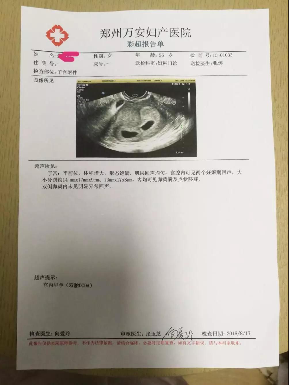 郑州一女子喜怀双胞胎宝宝 万安妇产医院帮圆妈妈梦