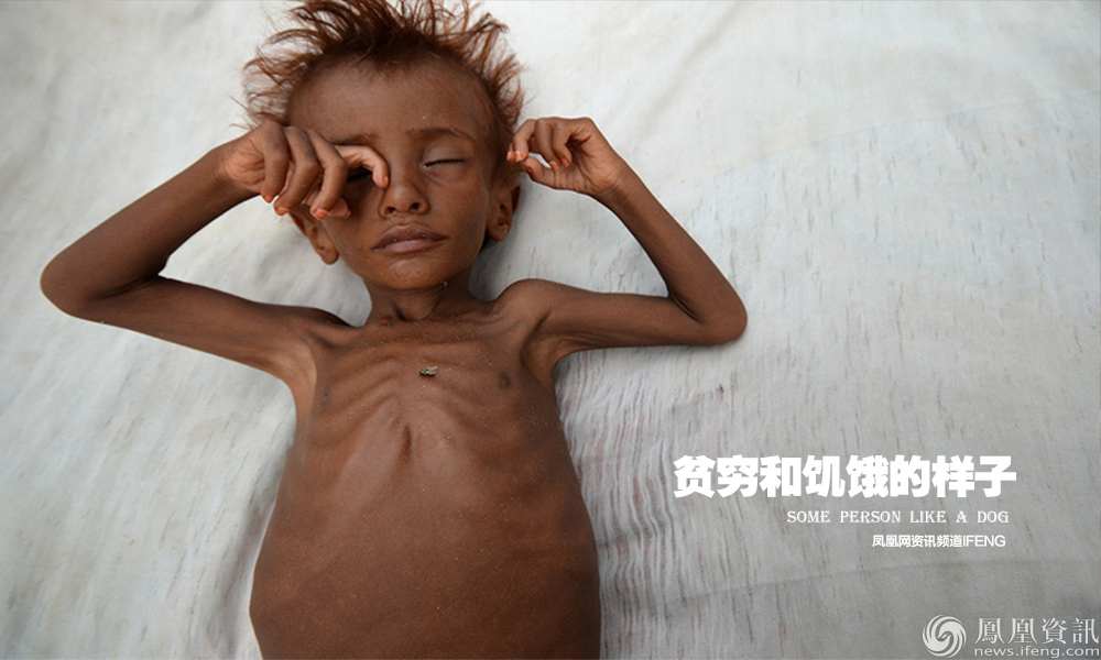 世界上饥饿的儿童图片
