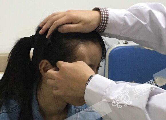 重庆一医院用3d技术为骨瘤患者打印颅骨 22岁女孩又美回来了