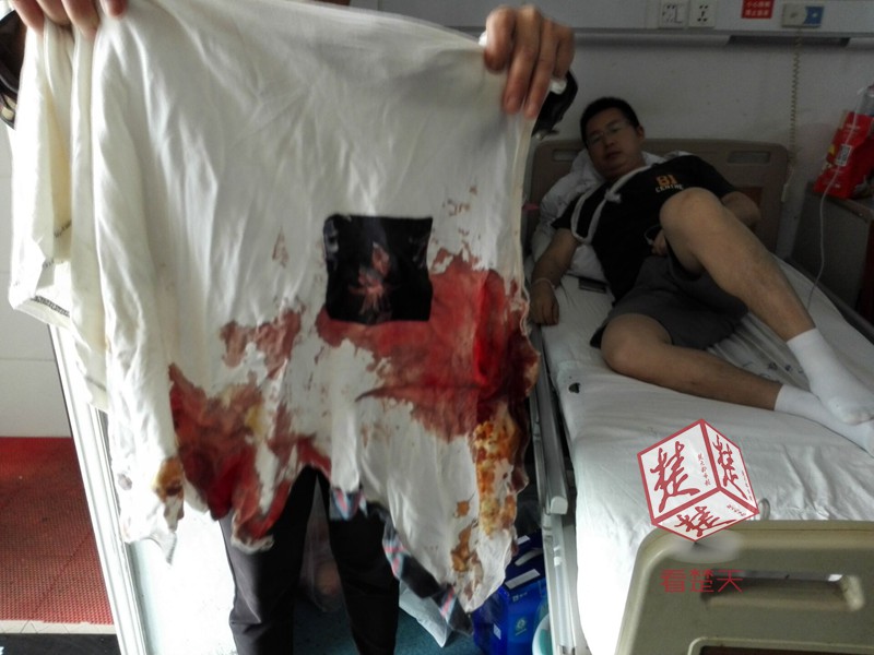 租户张先生染血的上衣