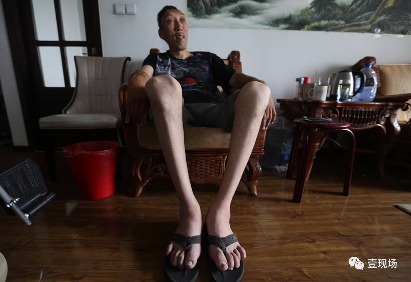 2.3米"巨人"魔术师进京求医 因膝盖受伤无法站立