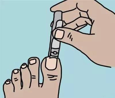 可能是因为你不会剪指甲!