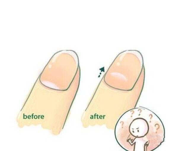 手指上的月牙痕代表什么