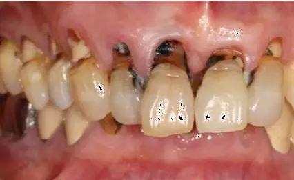 你的牙齿快被刷断了!