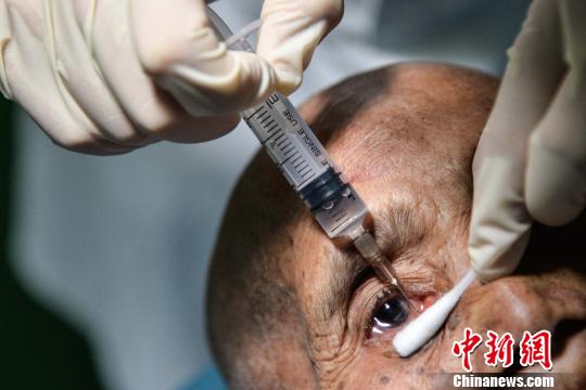 图为一名眼疾患者接受检查. 洪坚鹏 摄