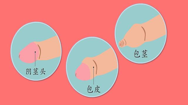 包皮过长必须手术割掉吗?不割会有哪些危害?